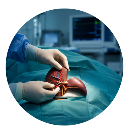 Liver Resection